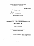 Гаспарян, Меружан Гургенович. Боль при пульпите: клинические и патофизиологические особенности: дис. кандидат медицинских наук: 14.00.21 - Стоматология. Тверь. 2009. 119 с.