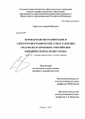 Терегулов, Андрей Юрьевич. Коронароангиографические и электротопографические сопоставления очагов желудочковых аритмий при ишемической болезни сердца: дис. кандидат медицинских наук: 14.01.13 - Лучевая диагностика, лучевая терапия. Казань. 2013. 124 с.