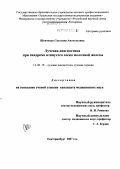 Шевченко, Светлана Анатольевна. Лучевая диагностик при синдроме втянутого соска молочной железы: дис. кандидат медицинских наук: 14.00.19 - Лучевая диагностика, лучевая терапия. Москва. 2007. 166 с.