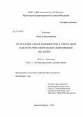 Локшина, Анна Александровна. Мультиспиральная компьютерная томография в диагностике неорганных забрюшинных опухолей: дис. кандидат медицинских наук: 14.01.12 - Онкология. Санкт-Петербург. 2013. 129 с.