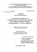 Тетерина, Наталья Владимировна. Патоморфологическое и клиническое исследование печени при лимфопролиферативных заболеваниях и острых лейкозах: дис. кандидат медицинских наук: 14.00.15 - Патологическая анатомия. Новосибирск. 2006. 136 с.