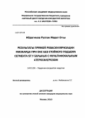 Ибрагимов, Рустам Марат Оглы. Результаты прямой реваскуляризации миокарда при ОКС без стойкого подъема сегмента ST у больных мультифокальным атеросклерозом: дис. кандидат медицинских наук: 14.01.26 - Сердечно-сосудистая хирургия. Москва. 2013. 158 с.